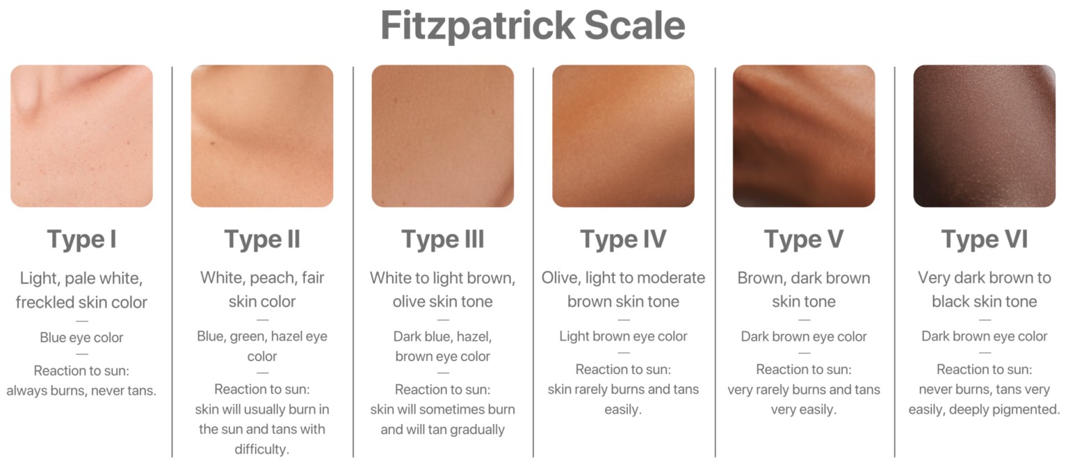 Fitzpatrick skin type scale chart