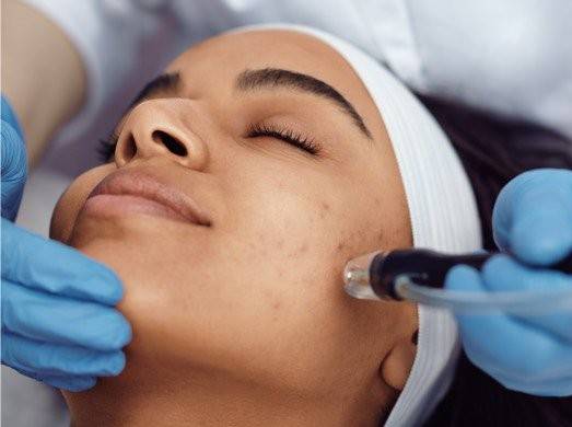 Microdermabrasion facial at Phiz Spa